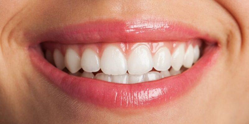 Clareamento Dental: Técnicas, Riscos e Benefícios