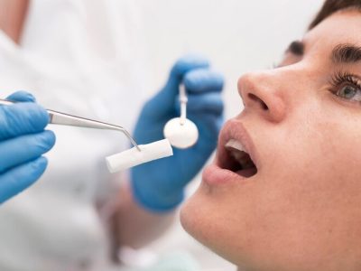 Dentes do Siso: Extração e Cuidados Necessários